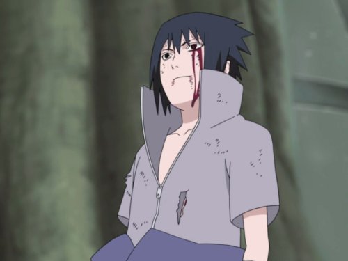 Naruto Shippuden Episode 211: Danzo Shimura